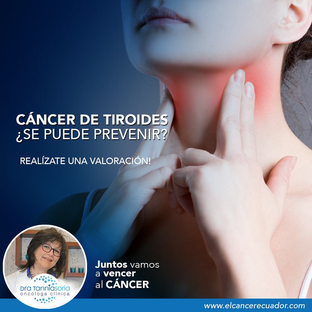 cáncer de tiroides, Dra Tannia Soria Oncóloga Clínica, Oncologos Quito