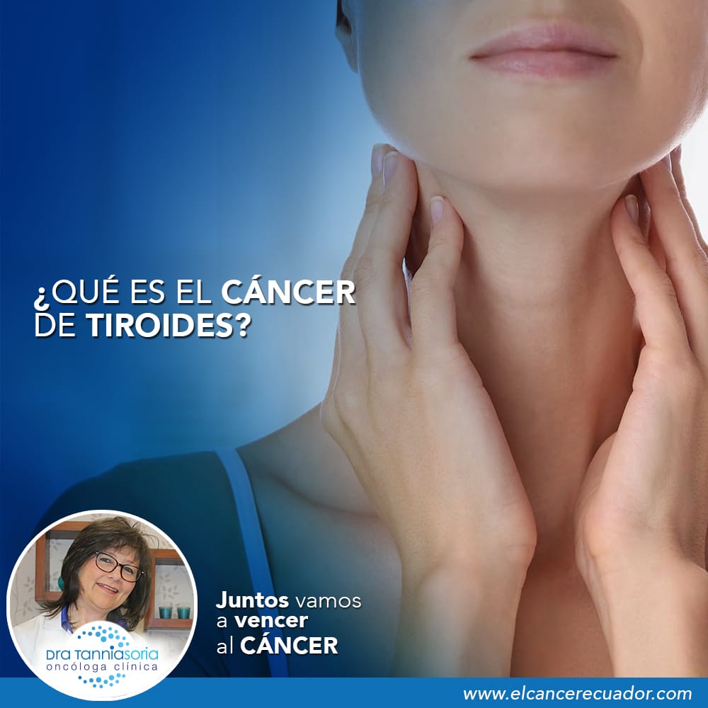 Cáncer de tiroides, Dra Tannia Soria Oncóloga Clínica, Oncologos Quito