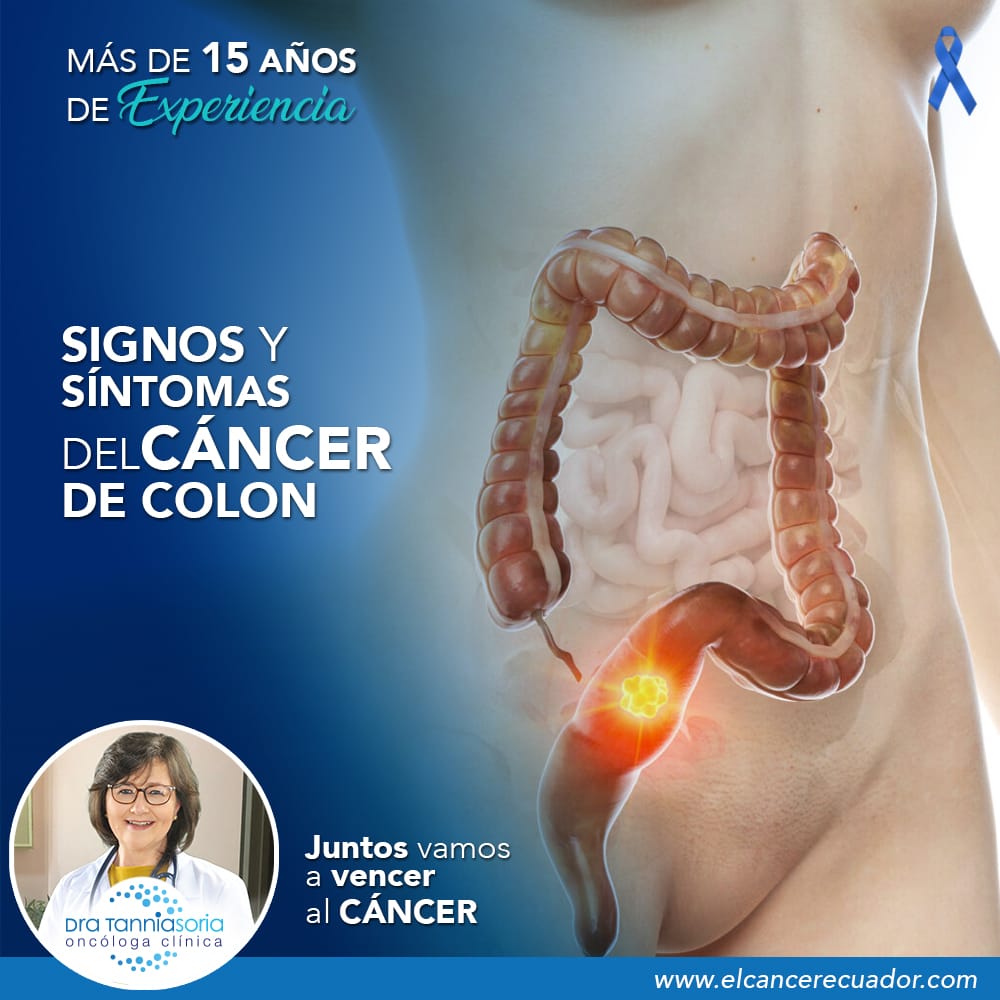 Signos y síntomas del cáncer de colon