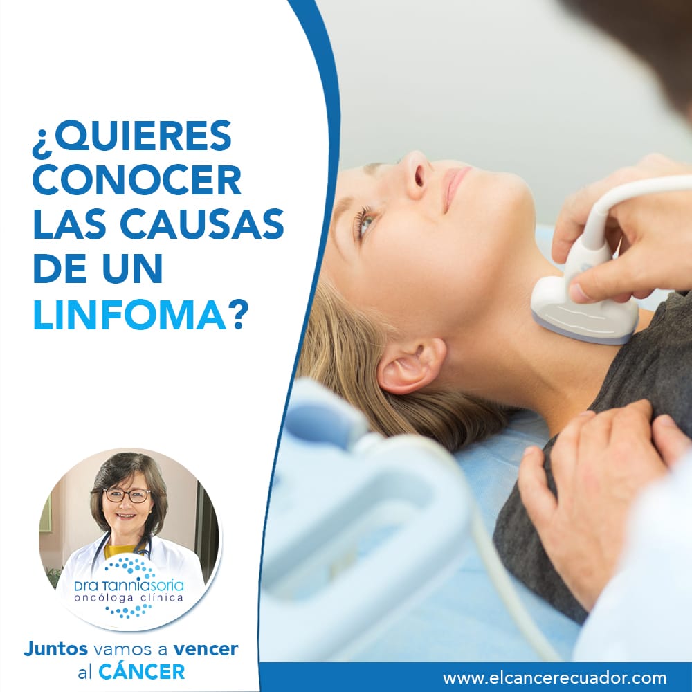 Causas de un linfoma