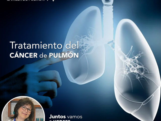 Tratamiento del cáncer de pulmón