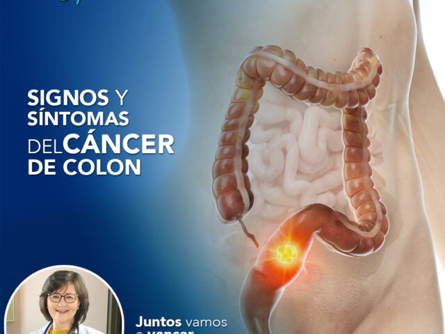 Signos y síntomas del cáncer de colon
