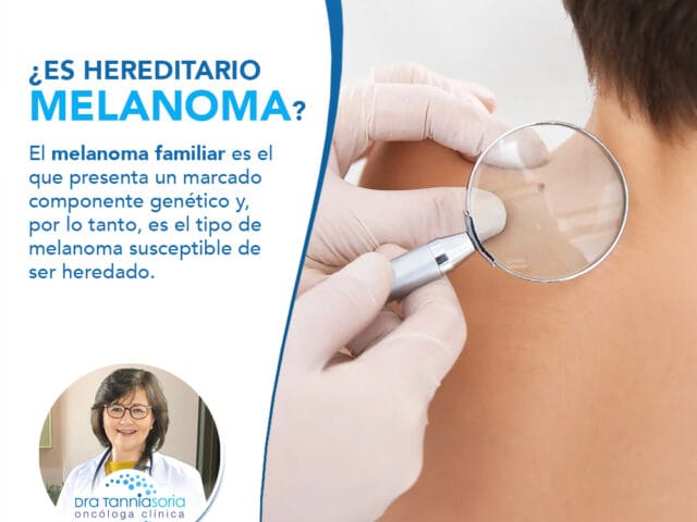 ¿Es hereditario el melanoma?