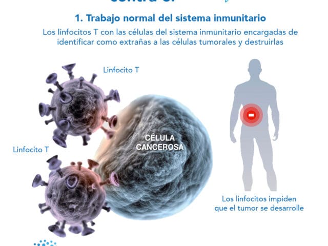 Así funciona la inmunoterapiacontra el cáncer