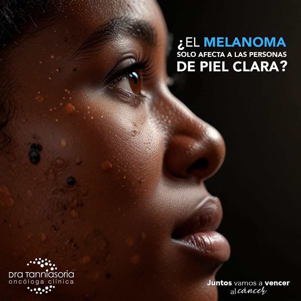 El melanoma solo afecta a las personas de piel clara