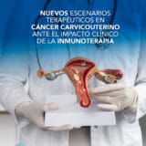 Inmunoterapia en cáncer cervicouterino