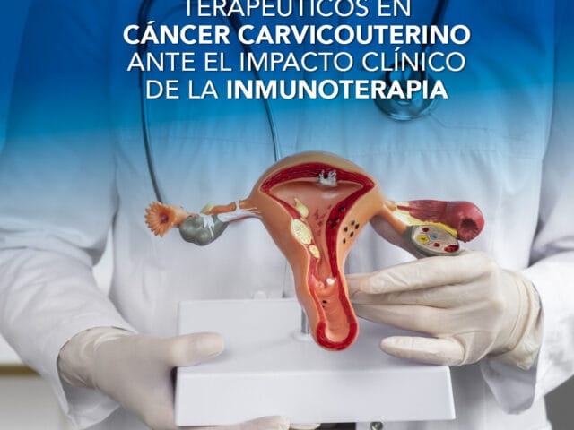 Inmunoterapia en cáncer cervicouterino: nuevos escenarios terapéuticos