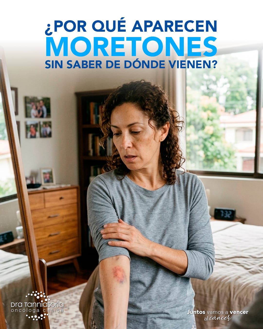 ¿Por qué aparecen moretones sin saber de dónde vienen?